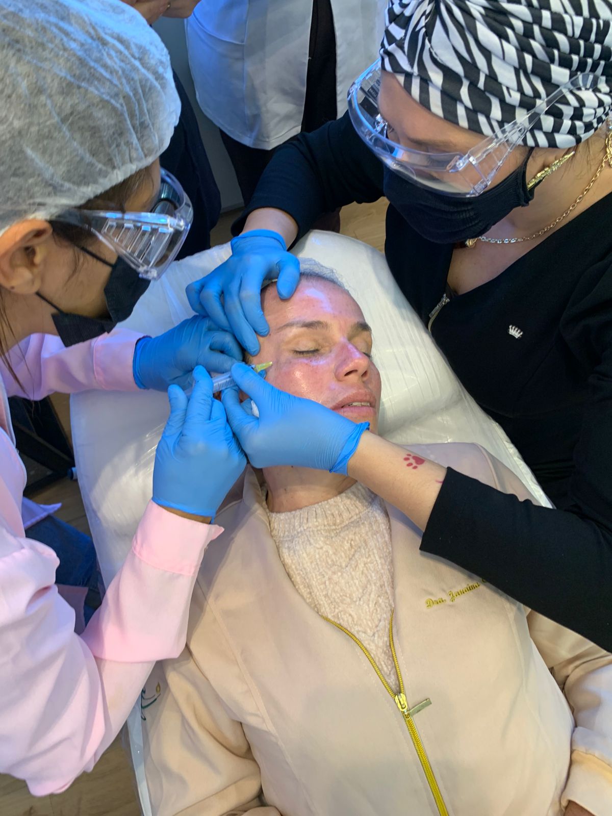 PRP Facial
