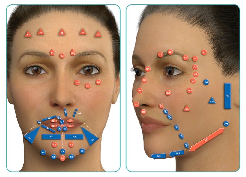 Ilustração das zonas de risco vascular da face usada em curso de anatomia para injetáveis