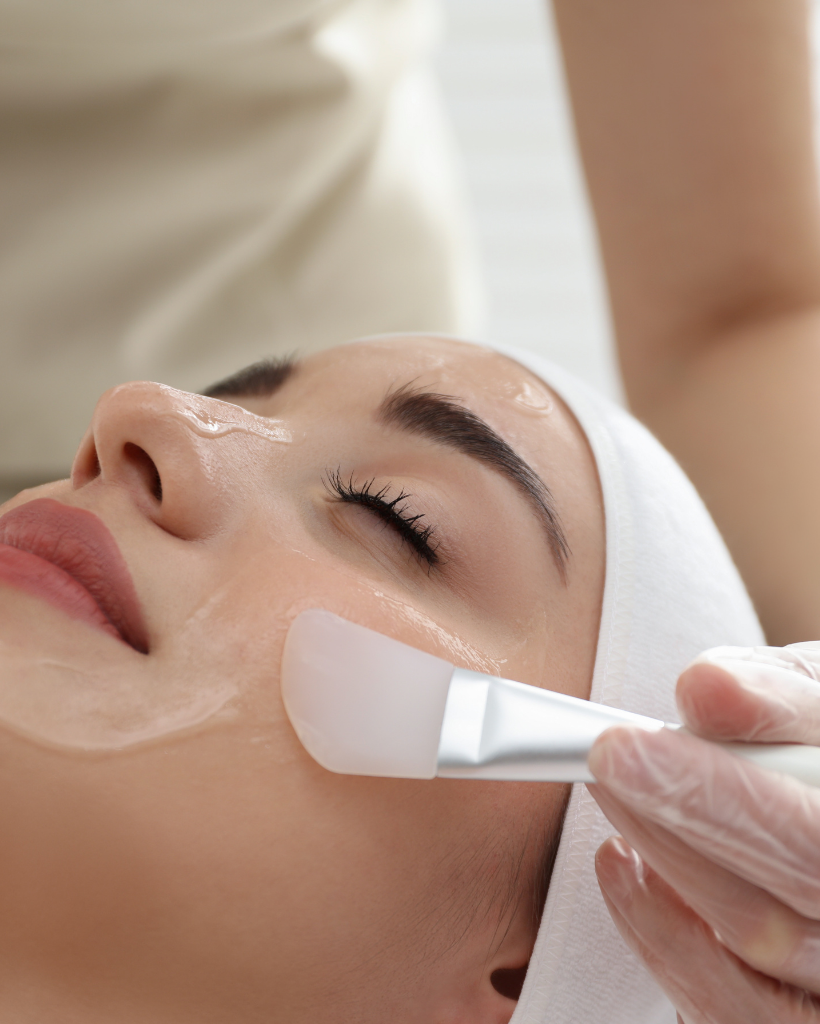 Peelings Químicos (1)