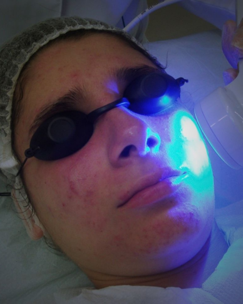 laixer baixa frequencia foto